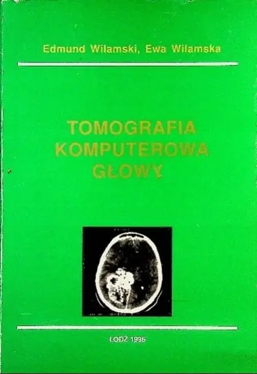 Tomografia komputerowa głowy Okazja